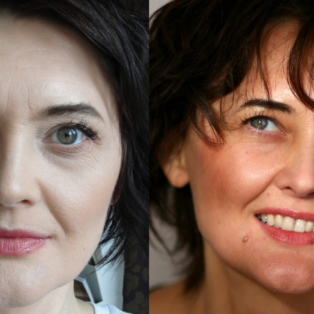 Jak wyszłam z endometriozy?